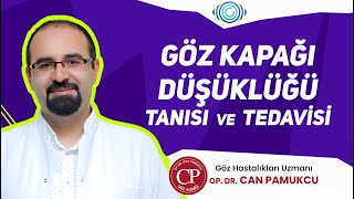 Göz Kapağı Düşüklüğü Tanısı ve Tedavisi  Dr Can PAMUKCU [upl. by Nimajnab918]