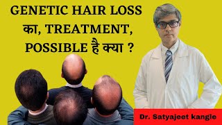 Genetic Hair Loss Treatment  Dr Satyajeet Kangle [upl. by Dorlisa]