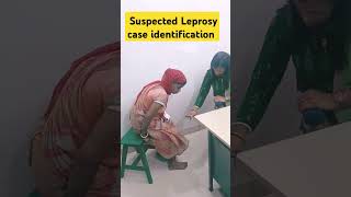 Suspected Leprosy leprosy odia motivation shots [upl. by Ahsinoj546]