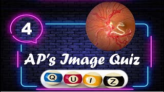 APs Image Quiz 4 [upl. by Kimon]