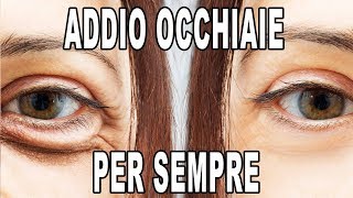 Come ELIMINARE le OCCHIAIE Per Sempre [upl. by Larner]