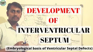 DEVELOPMENT OF INTERVENTRICULAR SEPTUM  VSD [upl. by Fazeli]