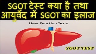 SGOT Test in hindi – क्यों और किस कारण बढ़ता है SGOT – sgot kya hai [upl. by Ecirtaed]