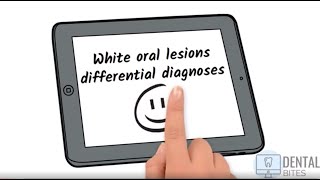 ORAL MEDICINE  WHITE lesions differential diagnosis  UK undergraduate dentistry [upl. by Donall]