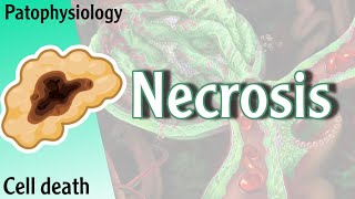 Pathophysiology  Necrosis cell death Hani Laith شرح [upl. by Aiyot714]