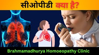 COPD Effective Homeopathic Solutions for Relief and Management [upl. by Anitserp]