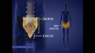 Spinal Cord Injuries I Areas Affected by Level of Injury [upl. by Geminian]