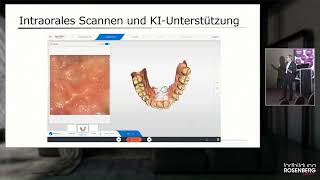 Trailer «CAD  CAM Scanner» – Prof Dr Albert Mehl [upl. by Kapeed536]