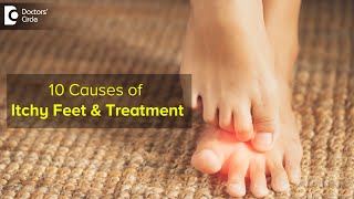 10 CAUSES OF ITCHY FEET How to get relief  Right Treatment  Dr Urmila Nischal Doctors Circle [upl. by Aikrehs663]