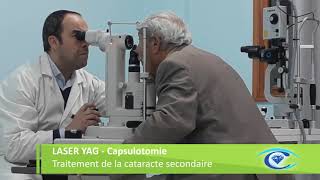 Traitement de la cataracte secondaire par le laser Capsulotomie YAG [upl. by Pierrette379]