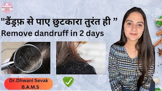 Remove dandruff in 2 days at home  DrDhwani Sevak [upl. by Hymen]