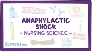 Anaphylactic shock Clinical Nursing Care [upl. by Airb]