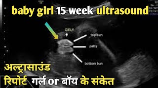 sonography  ultrasound  baby  pregnancy pregnant [upl. by Aseen239]