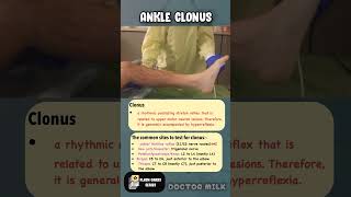 Ankle clonus neetpg usmle [upl. by Gona928]