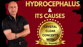 Causes of Hydrocephalus  What is going on in the brain  Dr Najeeb [upl. by Annuhsal]