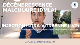 Dégénérescence maculaire liée à lâge DMLA et injection intravitréene IVT Pole Ophtalmologique [upl. by Sorcha482]