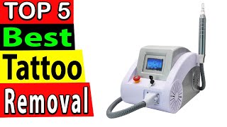 Best Laser Tattoo Removal In 2024 TOP 5 [upl. by Nur]