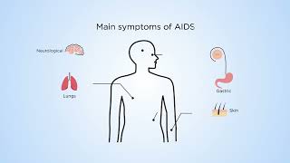 Why are macrophages more relevant than T cells in HIV lung disease [upl. by Aisatan]