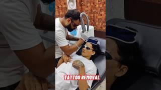 Face Tattoo removal 😱😱😱😱😱🔚🔚tattoo tattooremoval remove tattooart tattooartist tattoodesign [upl. by Cletis507]