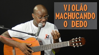 Violão Machucando o Dedo  SOLUÇÕES [upl. by Anairol]