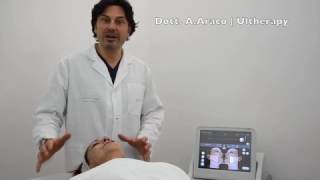 Esecuzione Ultherapy Lifting del Volto Non Chirurgico [upl. by Ecined]