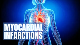 Myocardial Infarction  Symptoms Treatment amp Recovery [upl. by Hester968]