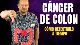 CÁNCER de COLON 🦀 Detéctalo a tiempo 🦀 Causas Diagnóstico Síntomas Prevención  Visíta Médica [upl. by Jeffy]