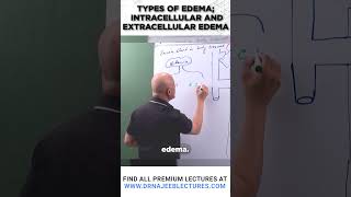 Types of edema Intracellular and extracellular edema [upl. by Meagher]