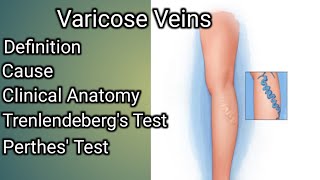 Varicose veins [upl. by Atiuqel689]