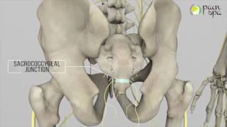 Coccyx Pain amp Ganglion Impar Block [upl. by Wehttam]