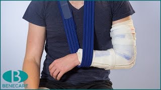 How To Apply a Elbow Drop Out Splint [upl. by Rochette]