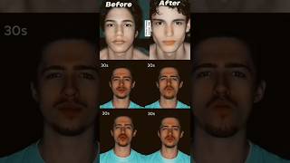 How to Get a Defined Jawline Without Mewing or Exercises [upl. by Hras]