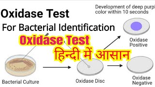 Oxidase test in hindi  Bacterial identification  Microbiology [upl. by Brechtel654]