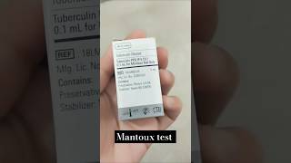 Mantoux test  Tuberculin skin test  TB test  Mycobacterium tuberculosis test tbtest mantoux [upl. by Evyn]