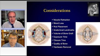 Sagittal Imbalance and Minimally Invasive Spine Surgery Preview [upl. by Eeralav]