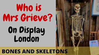 Who is Mrs Grieve  Body Sold For Anatomy  Skeletons and Bones on Display  London [upl. by Georgiana530]