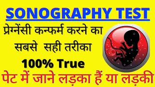 Sonography Kaise Hoti Hain  Sonography se Kaise Jane Ladka hai ya Ladki  Sonography Report [upl. by Atoiyanap7]