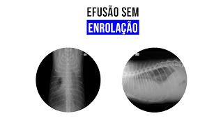 Caso clínico Efusão pleural [upl. by Houser]