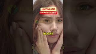 Sintomas ng Anemia Deficiency [upl. by Chloris194]