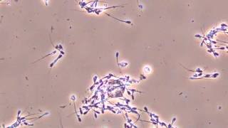 Moving pig sperm observed by biological [upl. by Yeldua]