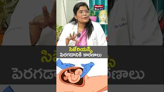 Rise of CSections Here Are the Reasons l Dr K Sarala shorts MedPlusONETV [upl. by Johnson586]