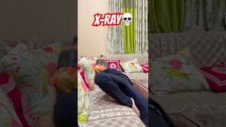 XRay krva dia shortsviral dailyshorts comedy shortvideo [upl. by Neelhtac]