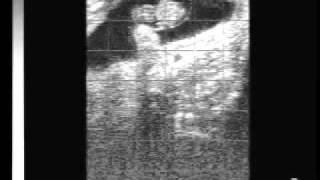 Bovine pregnancy 40 days with EasiScan ultrasoundwmv [upl. by Jacintha173]