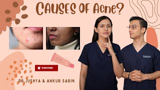 Cause of Acne  Root Causes of Acne  Acne के कारण  Dr Ankur amp Dr Jushya Bhatia [upl. by Ainimre]