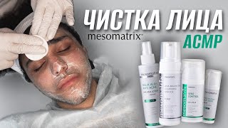 Чистка лица АСМР mesomatrix [upl. by Jenness]