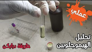 CBC 37 Drabkins cyanmethemoglobin method [upl. by Neve]