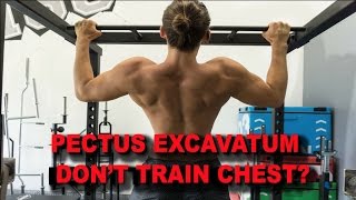 TRAINING CHEST CAN MAKE PECTUS WORSE [upl. by Nettle]