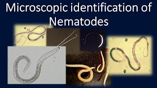 Microscopic identification of NematodesNematodesParasitologyMLSAscaris [upl. by Lovett]