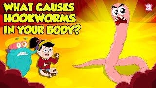 What causes Hookworm। Intestinal Worms Symptoms and Treatment  Worm Infection  Dr Binocs Show [upl. by Ainniz]