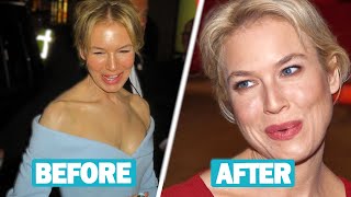 Renée Zellweger Plastic Surgery and Weight Loss Journey [upl. by Assiralk]